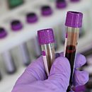 Blood Test Detecting Any Virus You Have Had Becomes Widespread